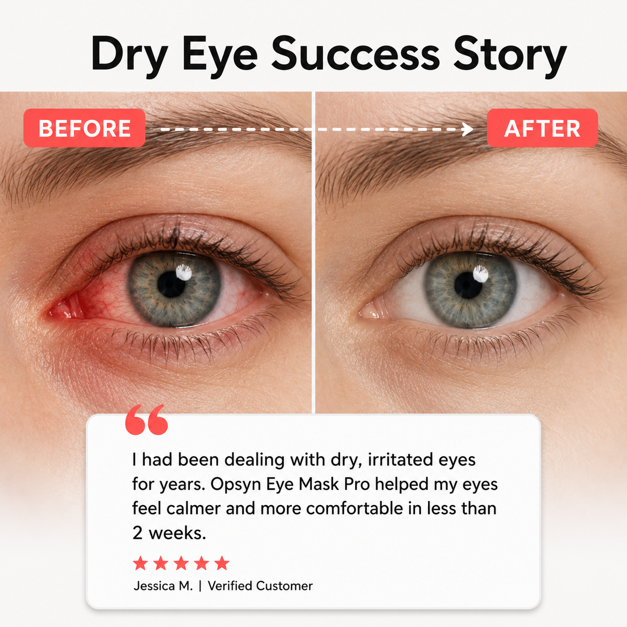 Opsyn Eye Mask Pro